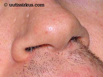 Nenä, sierainkarvat ja viiksetkin ovat kasvamaisillaan
